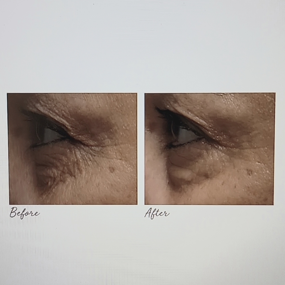 Elemis Peptide4 Eye Recovery Cream - Picture 6 of 7